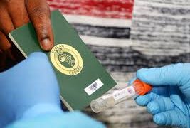 Le prix des tests PCR contre le covid-19 désormais à 30 milles Fcfa au Cameroun.